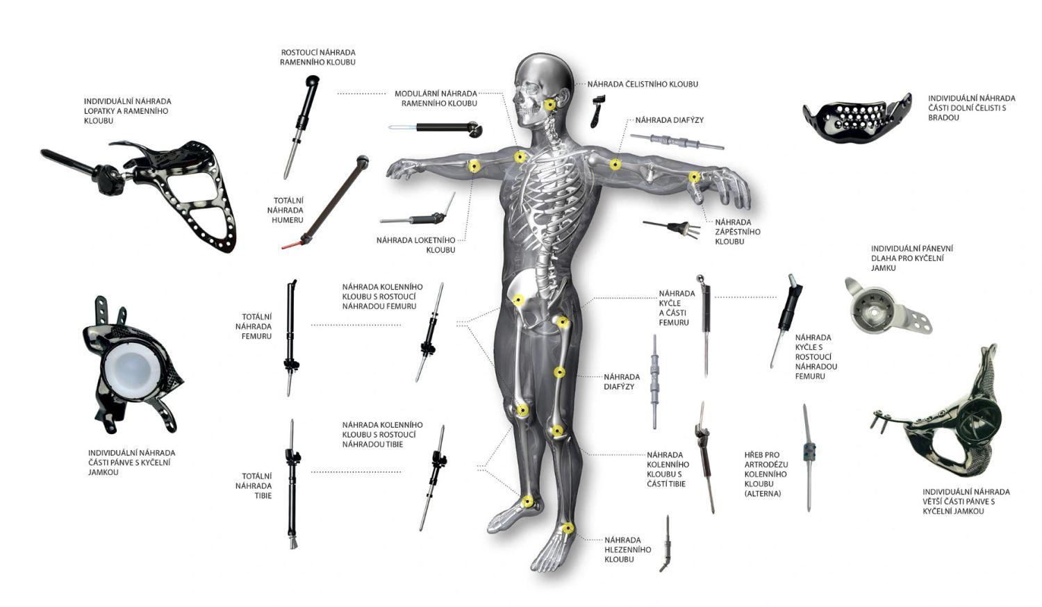  ◳ ProSpon_Onkologie-Individual_prehled_p1 (jpg) → (originál)