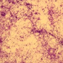 Salinispora tropica pod mikroskopem, obarvený preparát kristalovou violetí