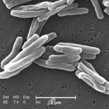 2 - Mycobacterium tuberculosis (Janice Carr, wikimedia)