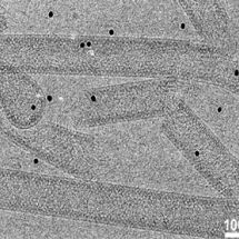 castice pod elektronovym mikroskopem