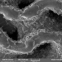 Porézní povrchy implantátu - snímek z elektronového mikroskopu - 100x_2