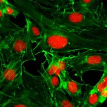 Fluorescencne znacene bunecne struktury 2