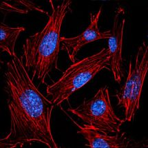 Fluorescencne znacene bunecne struktury 3