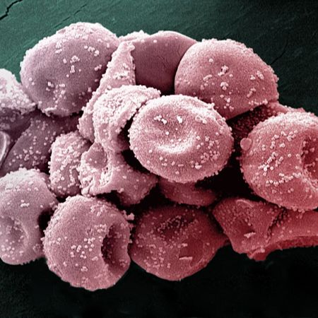 Cypress pollen grains observed in scanning electron microscopy (2200X).