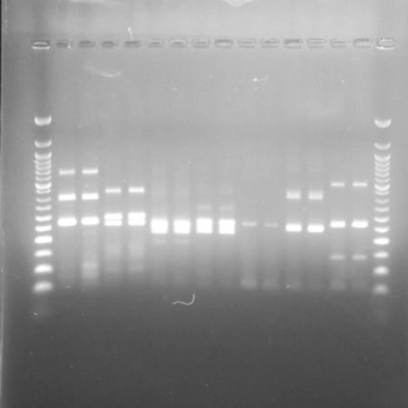 Amplifikované fragmenty DNA v agarosovém gelu (foto Diliara Akhatova)