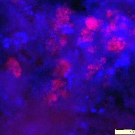 Anammox mikroorganismy (růžová) identifikované analýzou FISH (sonda Bfu613, Candidatus Brocadia fulgida). Autorka: Dana Vejmelková