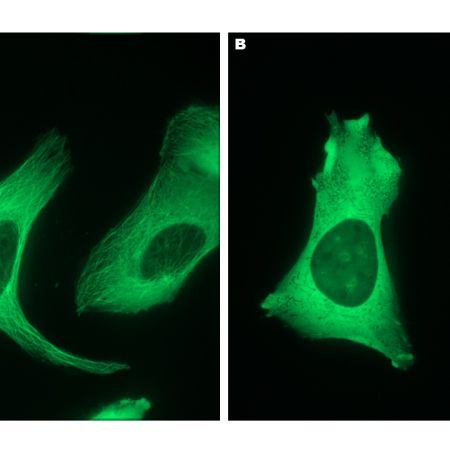 A) Buňky lidského osterosarkomu (U-2OS) se zeleně fluoreskujícími mikrotubuly, B) rozpad mikrotubul po vystavení buněk mitotickému jedu kolchicinu