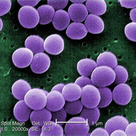 Staphylococcus aureus bacteria (Wikimedia commons, Photo Credit: Janice Haney Carr)