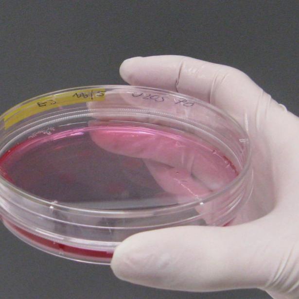  ◳ 3_zivocisne bunecne kultury (jpg) → (ořez 215*215px)