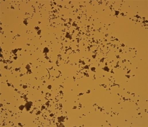 Saccharomyces cerevisiae (kvasinky) - menší zvětšení Saccharomyces cerevisiae (kvasinky) - menší zvětšení