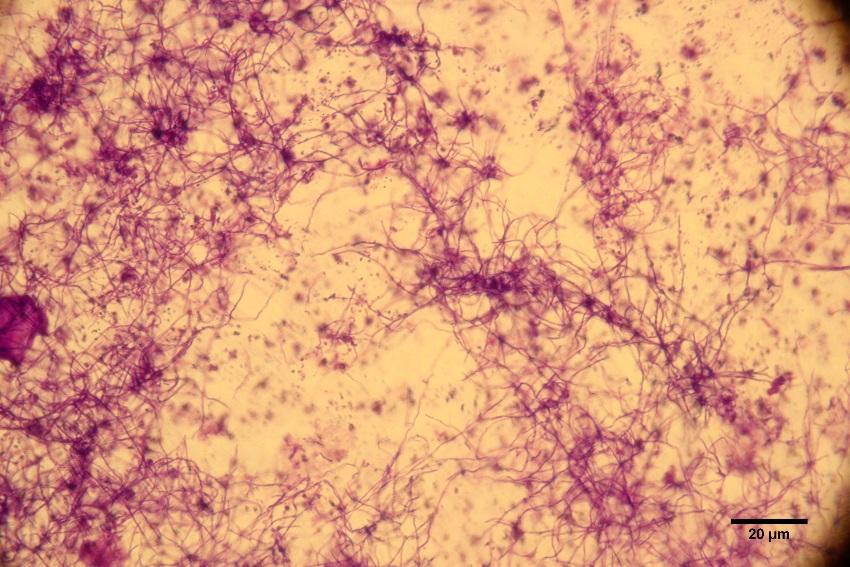 Salinispora tropica pod mikroskopem, obarvený preparát kristalovou violetí Salinispora tropica pod mikroskopem, obarvený preparát kristalovou violetí