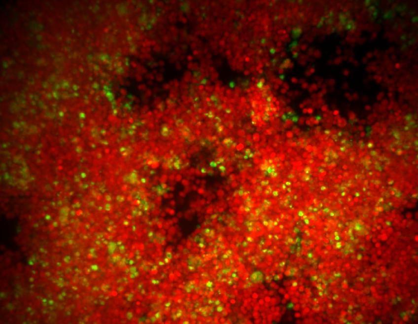 Obr. 1 - bakterie v biofilmu Obr. 1 - bakterie v biofilmu
