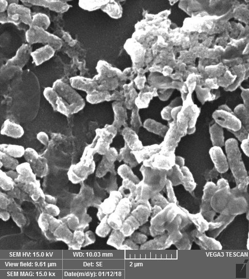 Obr. 3 - Elektronový snímek Lactobacillus plantarum 299v v přítomnosti cholesterolu; z obrázku je patrné navázání cholesterolu na buňky Obr. 3 - Elektronový snímek Lactobacillus plantarum 299v v přítomnosti cholesterolu; z obrázku je patrné navázání cholesterolu na buňky
