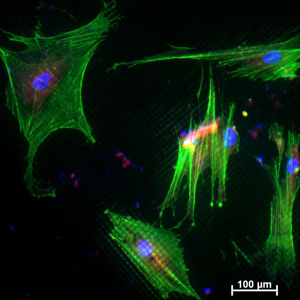 Mesenchymal stem cells after 24 hours cultured on titanium substrate (Autor - Mz888ms) Mesenchymal stem cells after 24 hours cultured on titanium substrate (Autor - Mz888ms)