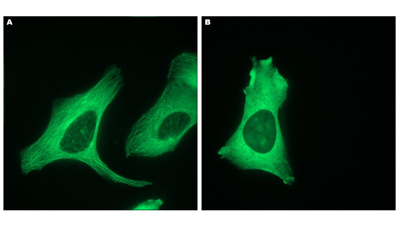 A) Buňky lidského osterosarkomu (U-2OS) se zeleně fluoreskujícími mikrotubuly, B) rozpad mikrotubul po vystavení buněk mitotickému jedu kolchicinu A) Buňky lidského osterosarkomu (U-2OS) se zeleně fluoreskujícími mikrotubuly, B) rozpad mikrotubul po vystavení buněk mitotickému jedu kolchicinu