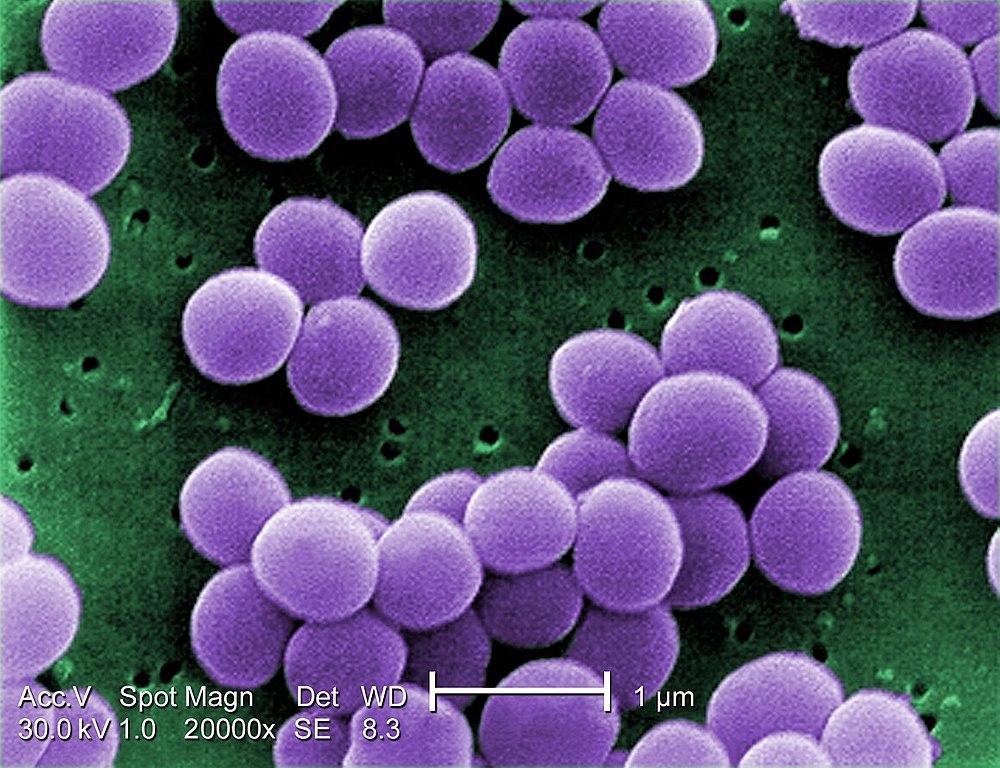 Staphylococcus aureus bacteria (Wikimedia commons, Photo Credit: Janice Haney Carr) Staphylococcus aureus bacteria (Wikimedia commons, Photo Credit: Janice Haney Carr)
