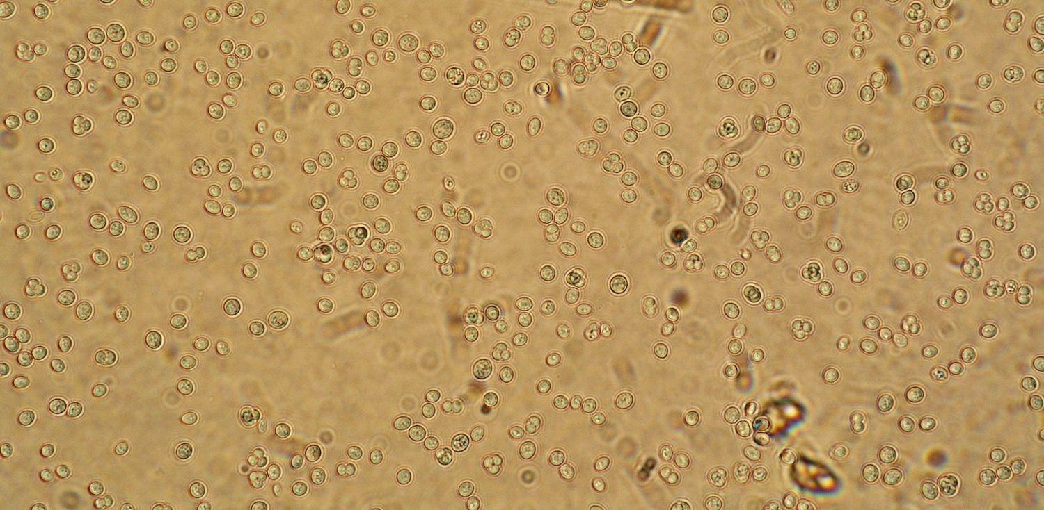 S.cerevisiae 3